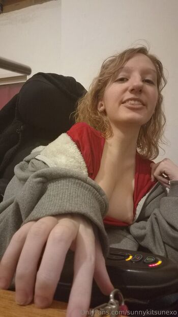 Full leaked Disabled girls private onlyfans photo